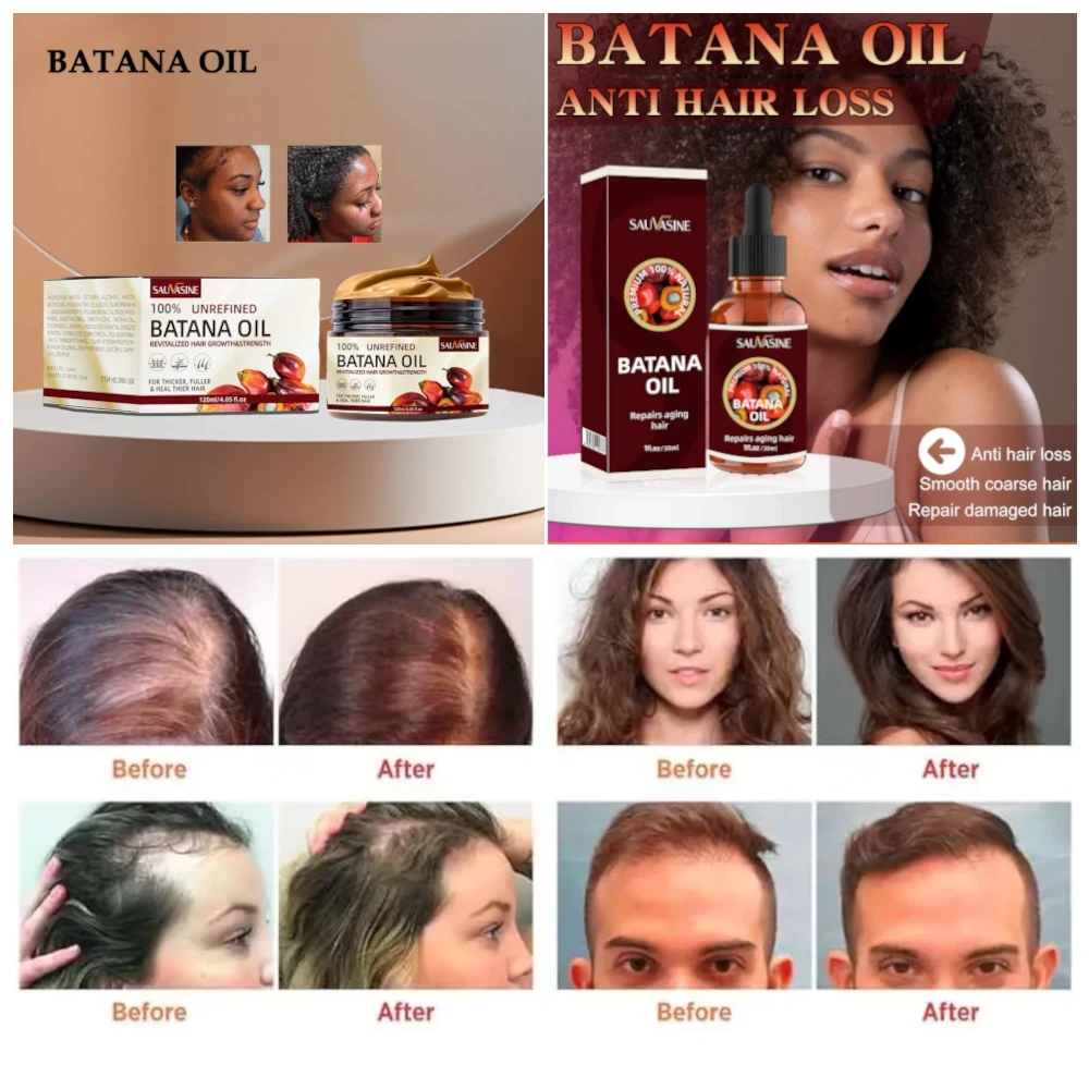 Batana Oil & Paste Bundle:Hair, Oil, Batana, Paste, Bundle, Scalp, Frizz, Feel, Truly, Healthy